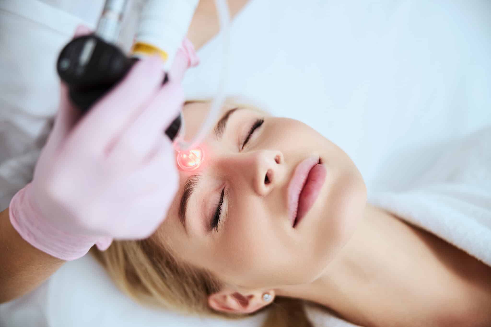 Laser Treatments